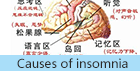 失眠治疗
